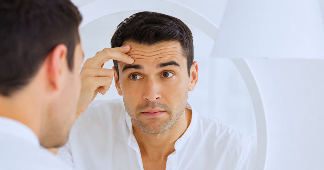 Líneas de expresión en hombres: por qué aparecen y qué hacer
